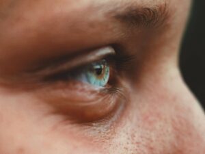 Nutrition eye 1
