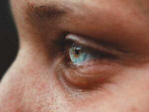 Nutrition eye
