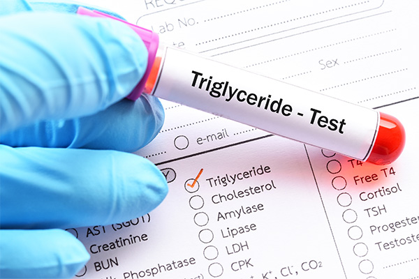 Triglyceriden: wat zijn het en wat zijn normale waarden? 2 Triglyceriden getest door een dokter